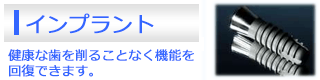 �C���v�����g