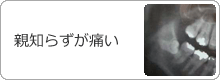 �e�m�炸���ɂ�